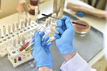 В Прикамье за сутки выявили 57 случаев заражения коронавирусом